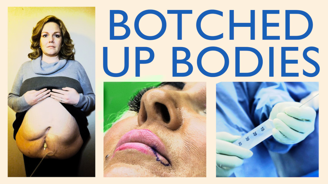 Botched Up Bodies